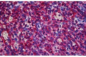 Human Spleen: Formalin-Fixed, Paraffin-Embedded (FFPE) (CAPZB 抗体  (AA 192-272))