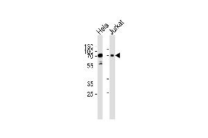 Western blot analysis of lysates from Hela, Jurkat cell line (from left to right), using Mouse Pak3 Antibody (N-term) (ABIN657852 and ABIN2846813). (PAK3 抗体  (N-Term))
