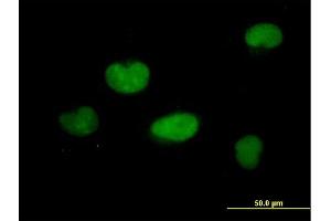 Immunofluorescence of purified MaxPab antibody to ZNF449 on HeLa cell. (ZNF449 抗体  (AA 1-518))