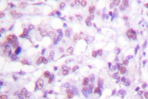 Image no. 1 for anti-V-Myb Myeloblastosis Viral Oncogene Homolog (Avian) (MYB) antibody (ABIN272041) (MYB 抗体)