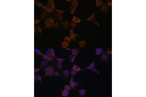 Immunofluorescence analysis of NIH-3T3 cells using AMPKβ1 Polyclonal Antibody (ABIN6129906, ABIN6146174, ABIN6146176 and ABIN7101403) at dilution of 1:100 (40x lens). (PRKAB1 抗体  (AA 1-80))