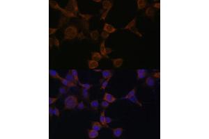 Immunofluorescence (IF) image for anti-Protein Kinase, AMP-Activated, beta 1 Non-Catalytic Subunit (PRKAB1) (AA 1-80) antibody (ABIN6146174)