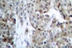 Image no. 2 for anti-BCL2-Associated Agonist of Cell Death (BAD) (pSer112), (pSer75) antibody (ABIN318169) (BAD 抗体  (pSer75, pSer112))