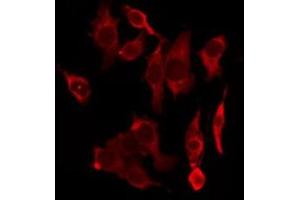 ABIN6277418 staining HeLa by IF/ICC. (P2RY4 抗体  (C-Term))
