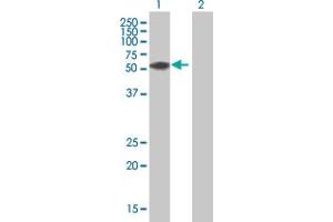 Western Blot analysis of ZNF276 expression in transfected 293T cell line by ZNF276 MaxPab polyclonal antibody. (ZNF276 抗体  (AA 1-373))