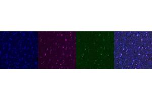 Immunohistochemistry (IHC) image for anti-Interferon gamma (IFNG) antibody (ABIN7456092) (Interferon gamma 抗体)