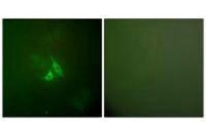 Immunofluorescence analysis of A549 cells, using Cox2 antibody. (PTGS2 抗体)