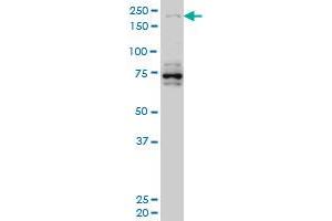 Western Blotting (WB) image for anti-Helicase with Zinc Finger (HELZ) (AA 1-100) antibody (ABIN523312)