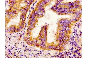 Immunohistochemistry (IHC) image for anti-Sodium Channel, Voltage-Gated, Type IX, alpha Subunit (SCN9A) (AA 1849-1988) antibody (ABIN7169929)