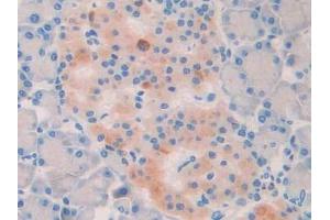DAB staining on IHC-P; Samples: Rat Pancreas Tissue (LOXL2 抗体  (AA 434-546))