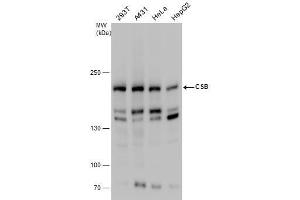 WB Image CSB antibody detects CSB protein by western blot analysis. (ERCC6 抗体  (Internal Region))
