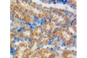 IHC-P analysis of Kidney tissue, with DAB staining. (GAS6 抗体  (AA 59-221))