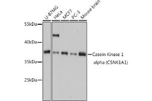 Western blot analysis of extracts of various cell lines, using Casein Kinase 1 alpha (Casein Kinase 1 alpha (CSNK1)) antibody (6225) at 1:1000 dilution. (CSNK1A1 抗体  (AA 100-200))