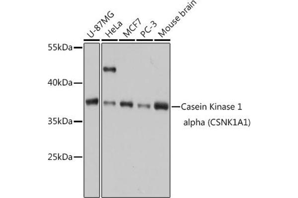CSNK1A1 抗体  (AA 100-200)
