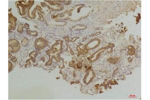 Immunohistochemistry (IHC) analysis of paraffin-embedded Human Prostate Tissue using Endothelin B Receptor Rabbit Polyclonal Antibody diluted at 1:200. (EDNRB 抗体)