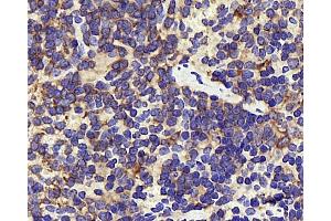 Immunohistochemistry analysis of paraffin-embedded mouse inflammation spleen using INPP5D Polyclonal Antibody at dilution of 1:300. (INPP5D 抗体)