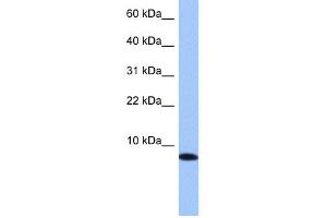 WB Suggested Anti-TNP1 Antibody Titration: 0. (TNP1 抗体  (N-Term))