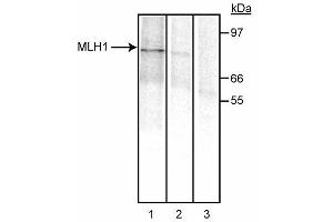 Immunoprecipitation of MLH1. (MLH1 抗体)