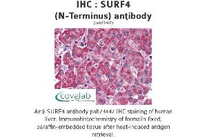 Image no. 1 for anti-Surfeit 4 (SURF4) (N-Term) antibody (ABIN1739778) (Surfeit 4 抗体  (N-Term))