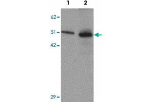 Western blot analysis of SLC39A7 in mouse brain tissue lysate with SLC39A7 polyclonal antibody  at (1) 0. (SLC39A7 抗体  (N-Term))
