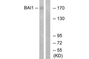 Western Blotting (WB) image for anti-Brain-Specific Angiogenesis Inhibitor 1 (BAI1) (Internal Region) antibody (ABIN6301192) (BAI1 抗体  (Internal Region))