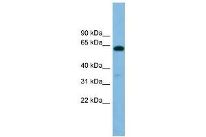 B4GALNT1 antibody used at 1 ug/ml to detect target protein.