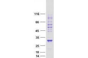 Validation with Western Blot (VHL Protein (Transcript Variant 1) (Myc-DYKDDDDK Tag))