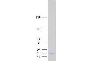 Western Blotting (WB) image for Myosin Regulatory Light Polypeptide 9 (MYL9) (Transcript Variant 2) protein (Myc-DYKDDDDK Tag) (ABIN2726681)