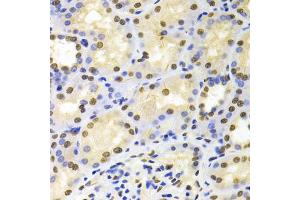 Immunohistochemistry of paraffin-embedded human kidney using HDGF Antibody (ABIN1876535) at dilution of 1:100 (40x lens). (HDGF 抗体)