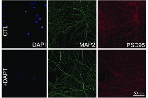 Representative confocal images of mouse cortical neurons using DAPI, MAP2, and PSD95 (cat.