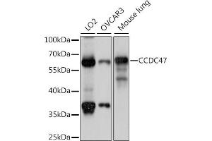 Western blot analysis of extracts of various cell lines, using CCDC47 antibody (ABIN7266438) at 1:1000 dilution. (CCDC47 抗体  (AA 224-483))