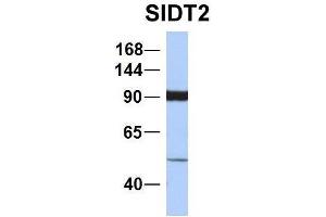 Western Blotting (WB) image for anti-SID1 Transmembrane Family, Member 2 (SIDT2) (N-Term) antibody (ABIN2778621)