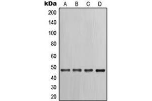 Western blot analysis of Cytokeratin 17 expression in PC12 (A), HeLa (B), A431 (C), NIH3T3 (D) whole cell lysates.