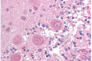 anti-BCL2L14 / BCL-G (C-Term) antibody