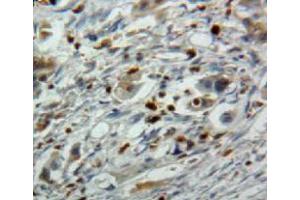 Used in DAB staining on fromalin fixed paraffin-embedded pancreas tissue (EBI3 抗体  (AA 21-229))