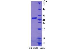 SDS-PAGE analysis of Human RND1 Protein. (RND1 蛋白)