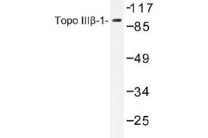 Image no. 1 for anti-Topoisomerase (DNA) III beta (TOP3B) antibody (ABIN272153) (TOP3B 抗体)