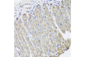 Immunohistochemistry of paraffin-embedded mouse stomach using BGLAP antibody at dilution of 1:100 (x40 lens). (Osteocalcin 抗体)