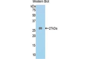WB of Protein Standard: different control antibodies against Highly purified E. (FAH ELISA 试剂盒)