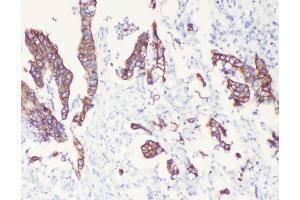 IHC analysis of Cytokeratin 8 using anti-Cytokeratin 8 antibody (ABIN5518853).