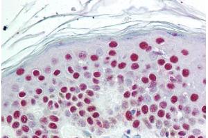 Human Skin (formalin-fixed, paraffin-embedded) stained with SET antibody ABIN297641 at 10 ug/ml followed by biotinylated goat anti-rabbit IgG secondary antibody ABIN481713, alkaline phosphatase-streptavidin and chromogen. (SET/TAF-I 抗体  (AA 66-81))