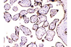 IHC analysis of Calpastatin using anti-Calpastatin antibody . (Calpastatin 抗体  (Middle Region))