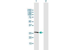 Western Blot analysis of NXNL1 expression in transfected 293T cell line by NXNL1 MaxPab polyclonal antibody. (NXNL1 抗体  (AA 1-212))