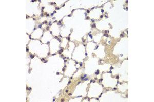 Immunohistochemistry (IHC) image for anti-Estrogen Receptor 2 (ESR2) (AA 1-280) antibody (ABIN6219642) (ESR2 抗体  (AA 1-280))