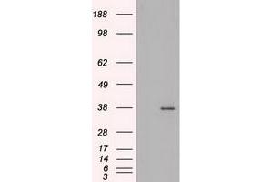 HEK293T cells were transfected with the pCMV6-ENTRY control (Left lane) or pCMV6-ENTRY BFGF (RC217426) (Right lane) cDNA for 48 hrs and lysed. (FGF2 抗体  (AA 10-155))