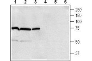 Western blot analysis of rat brain (lanes 1 and 4), mouse brain (lanes 2 and 5) and rat lung (lanes 3 and 6) membranes: - 1-3. (ADRB1 抗体  (2nd Extracellular Loop))