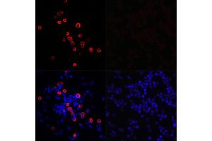 Immunofluorescence analysis of 293T cells transfected with SARS-CoV-2 3CLpro fusion protein (top left) and untreated 293T cells (top right) use SARS-CoV-2 3CLpro Rabbit pAb (ABIN7270151) at dilution of 1:100 (40x lens). (SARS-Coronavirus Nonstructural Protein 8 (SARS-CoV NSP8) 抗体)