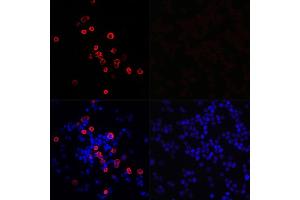 Immunofluorescence analysis of 293T cells transfected with SARS-CoV-2 3CLpro fusion protein (top left) and untreated 293T cells (top right) use SARS-CoV-2 3CLpro Rabbit pAb (ABIN7270151) at dilution of 1:100 (40x lens). (SARS-Coronavirus Nonstructural Protein 8 (SARS-CoV NSP8) 抗体)