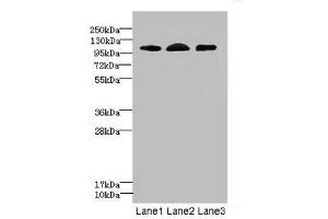 Western blot All lanes: EPHB4 antibody at 2. (EPH Receptor B4 抗体  (AA 300-540))