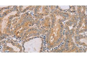 Immunohistochemistry (Paraffin-embedded Sections) (IHC (p)) image for anti-Tyrosine-Protein Phosphatase Non-Receptor Type 4 (PTPN4) antibody (ABIN7239395)